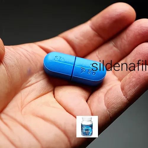 Sildenafil eg 50 mg prezzo